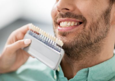 Dental Veneers