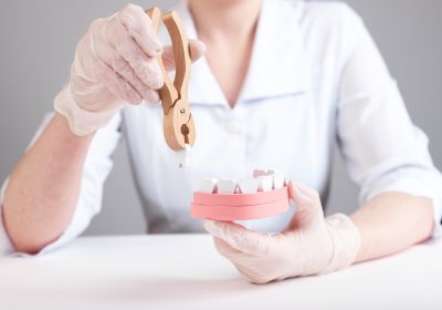 Wisdom Tooth Removal