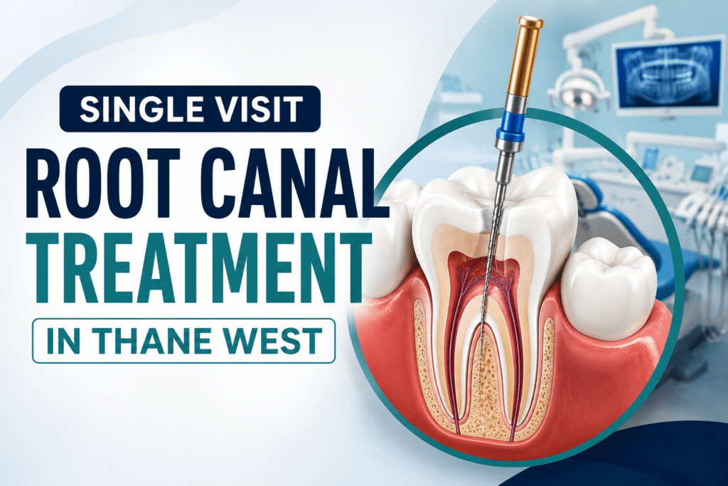 Single Visit Root Canal Treatment in Thane West