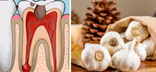 Tooth Pain Causes